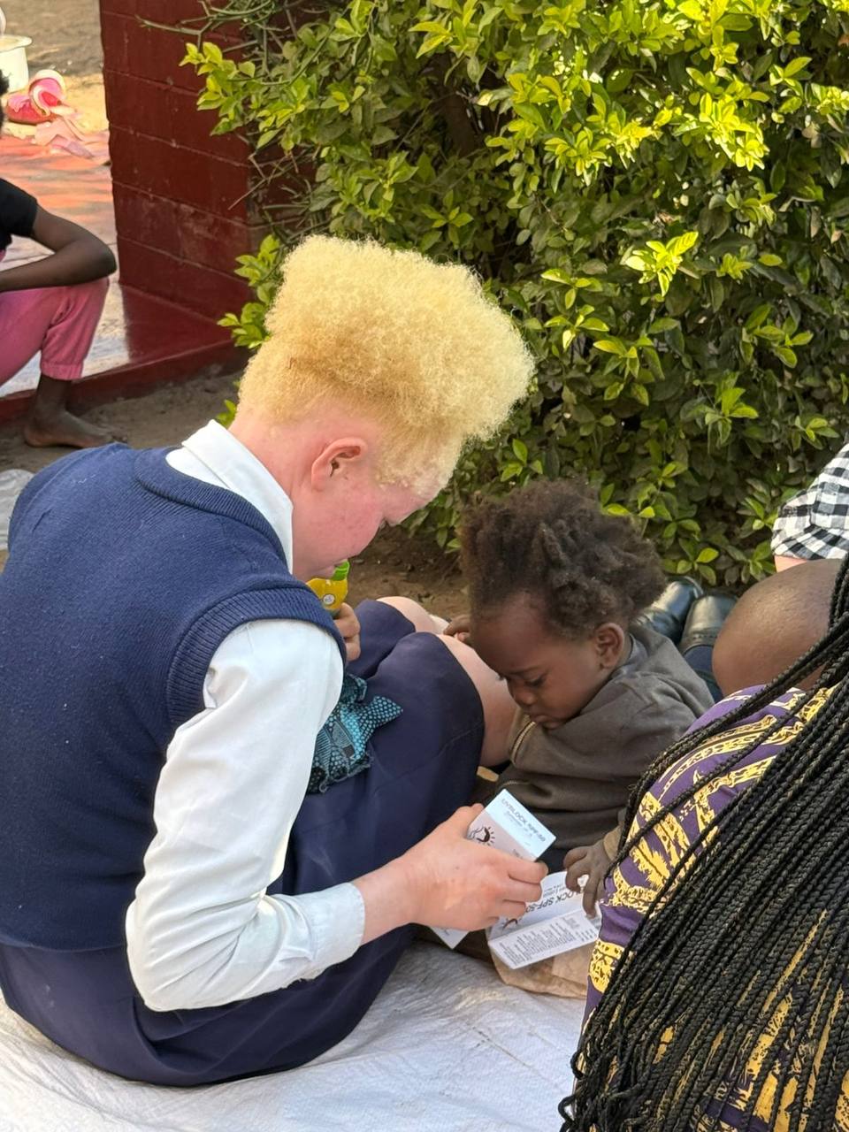 Sunscreen being shared with members of the local albinism community in Zambia
